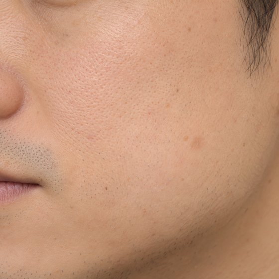 電球の下で、ライトを点けて撮った頬