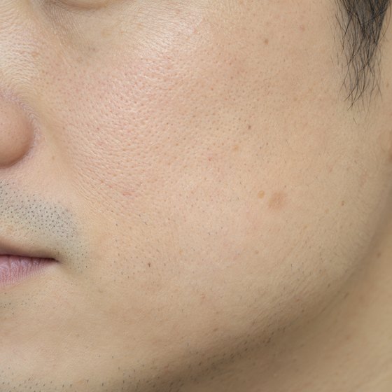 蛍光灯の下で、ライトを点けて撮った頬